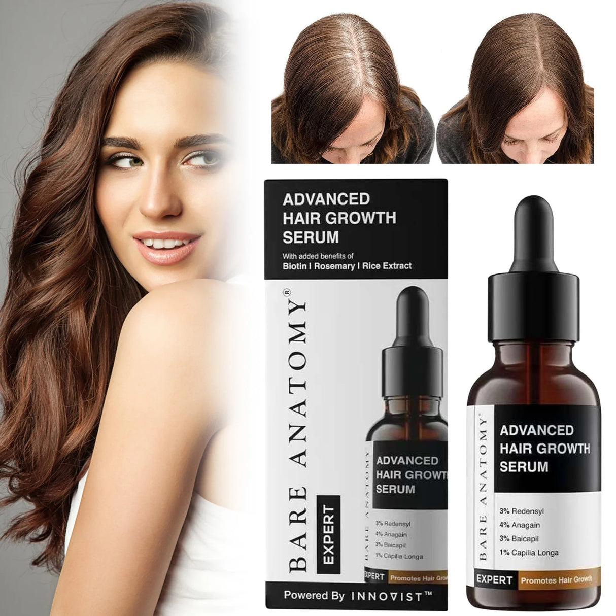Redensyl Hair Growth Serum