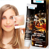 Anti-Acne Bee Venom Gel